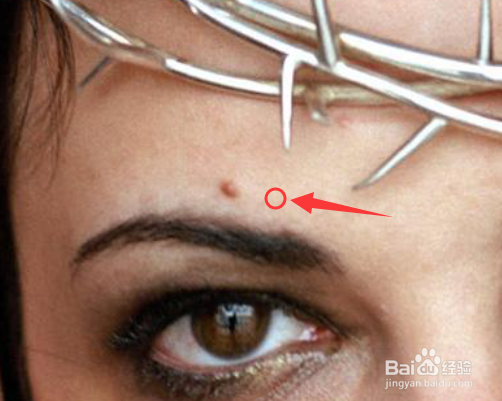 怎么简单地用PS祛斑祛痘