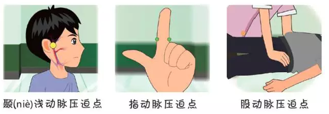 如何正确快速止血