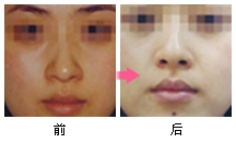 面部美容之道：[10]黑脸娃娃
