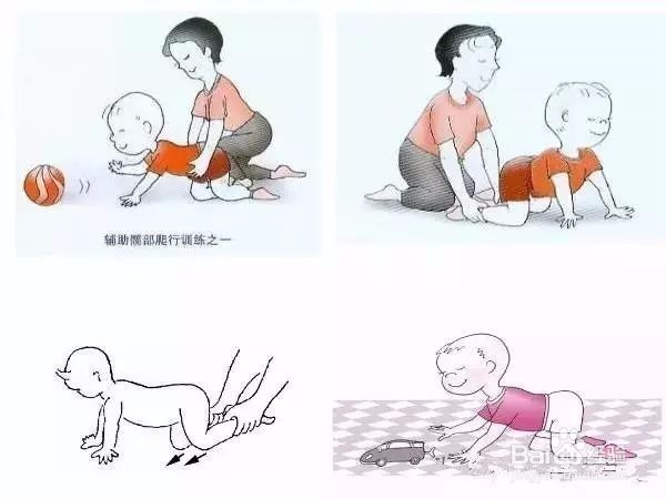 脑瘫康复训练图文版，从抬头训练到行走训练教程