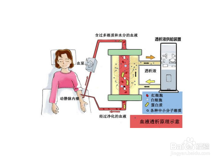 透析并发症的防止