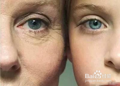 每天睡眠不足怎么办 不想变丑 就这样做