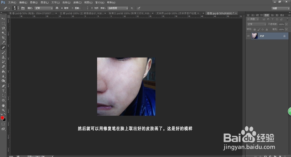 如何用PS去痘痘