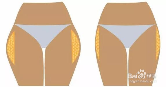 运动后怎么预防小腿变粗