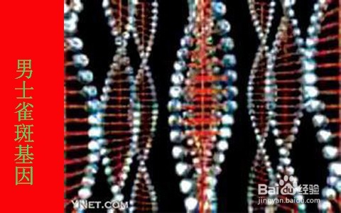 怎样调理男人脸上的斑/男性雀斑如何调理