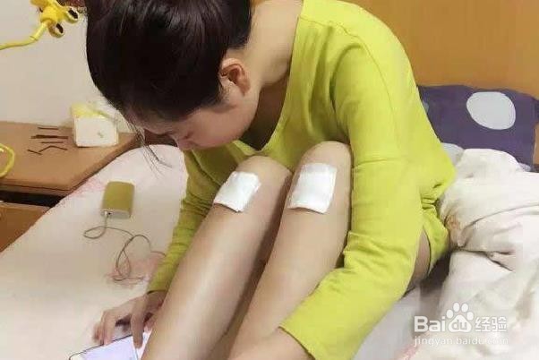 用自然疗法减轻血肿