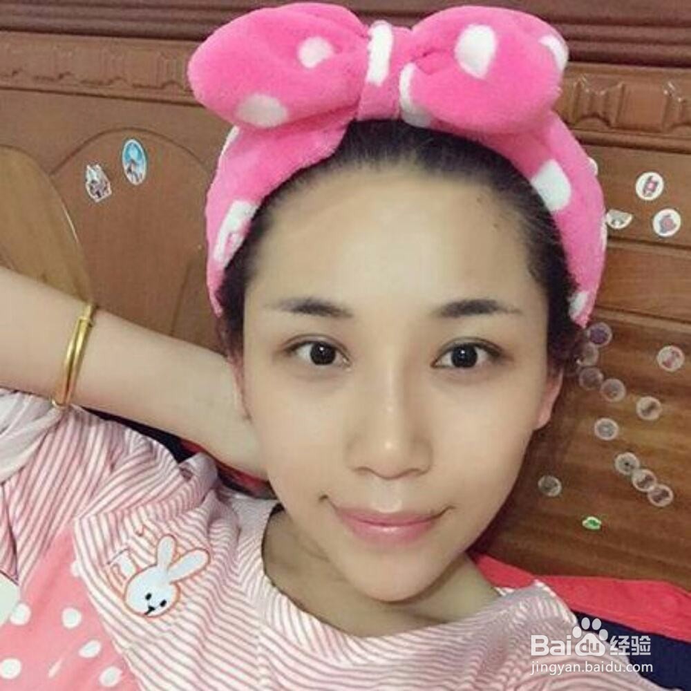 内双能割双眼皮吗