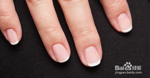 如何让消失的月牙白 重新快速长出来 百度经验