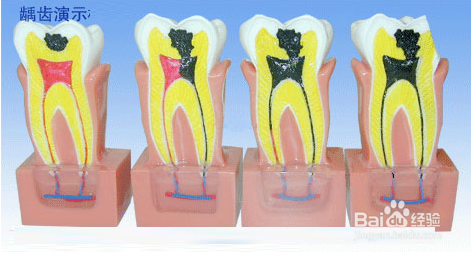 牙齿为什么会变黄？