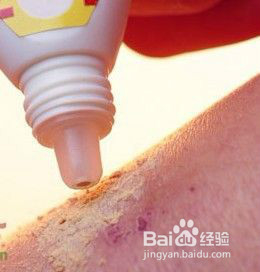 祛痘袪印好办法