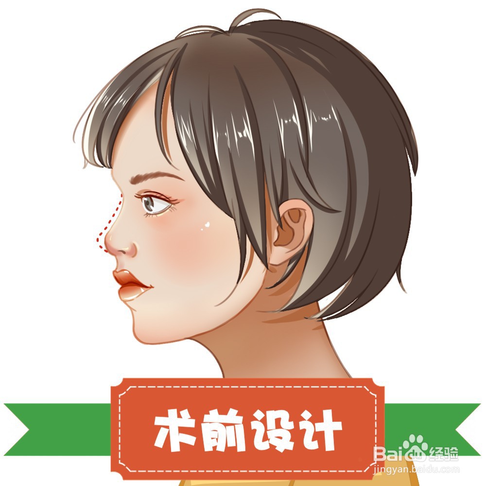 隆鼻手术过程