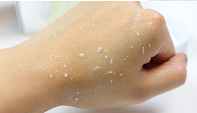 怎样判断脸上有角质