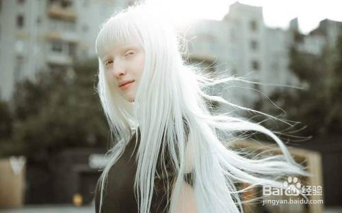 蚂蚁庄园白化病是一种什么病?蚂蚁庄园答案
