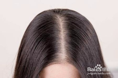 头发爱出油怎么办？