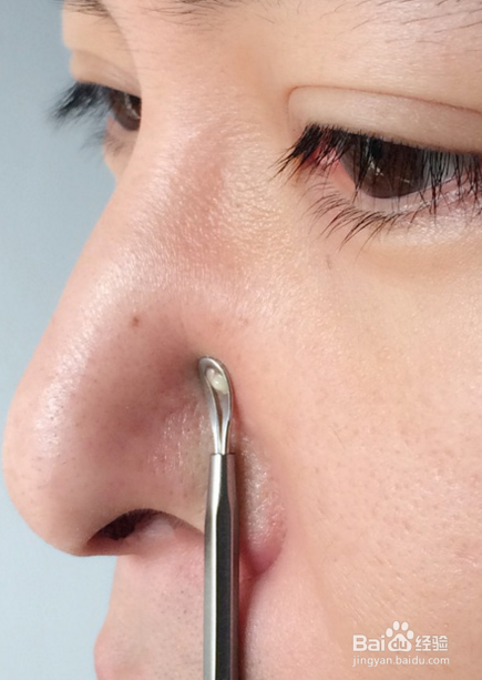 一周内有效缓解控制黑头粉刺的洗面方法