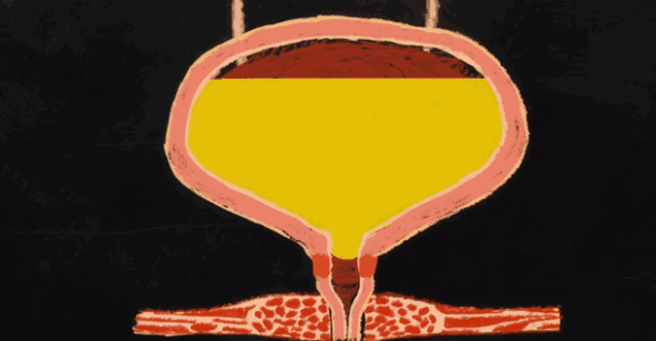 一喝水就内急和喝水不上厕所的人,哪个更健康?