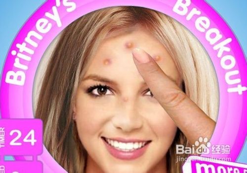 额头长痘痘怎么办