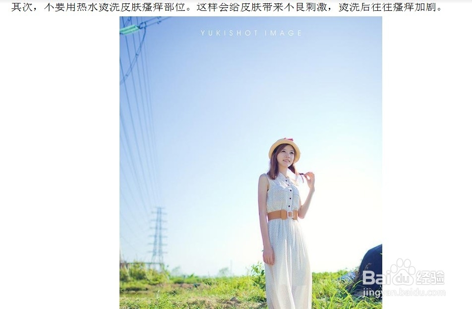 皮肤瘙痒是怎么回事