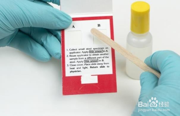 结肠癌的十大体征