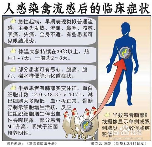 如何预防h7n9禽流感