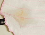 教你怎样做苹果醋