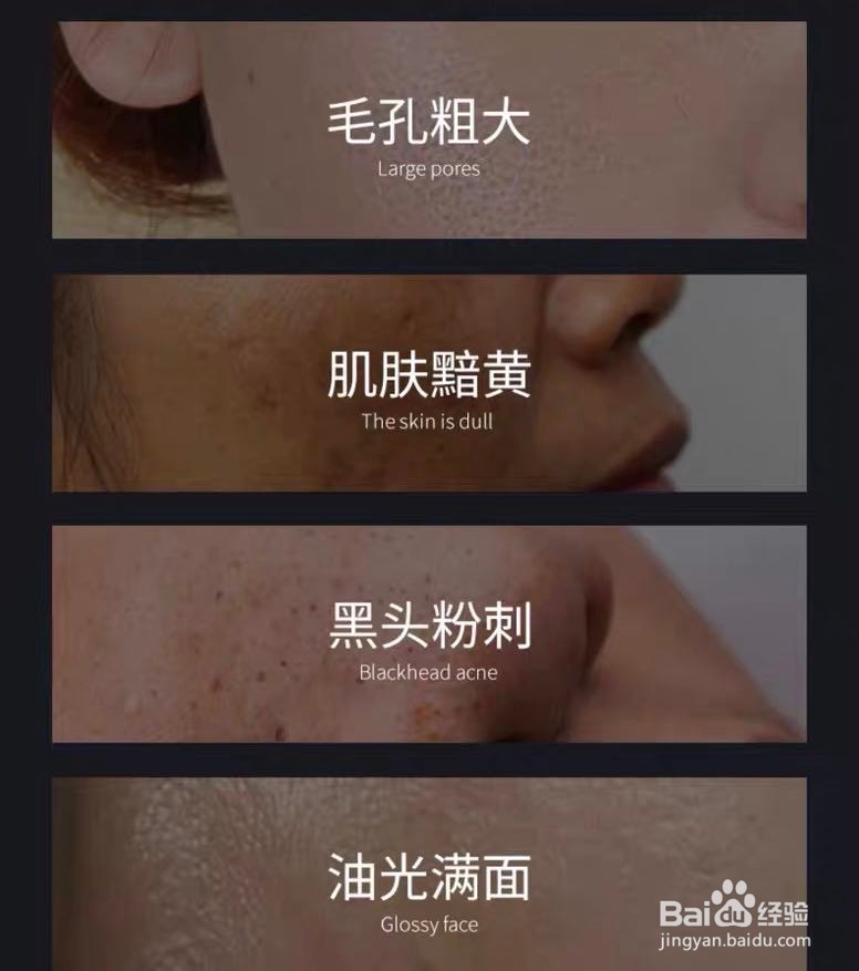 吸黑头面膜怎么用