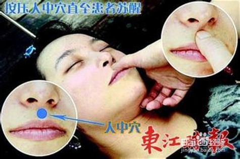 中暑了怎么应急抢救