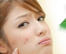 脸上长痘痘怎么清除