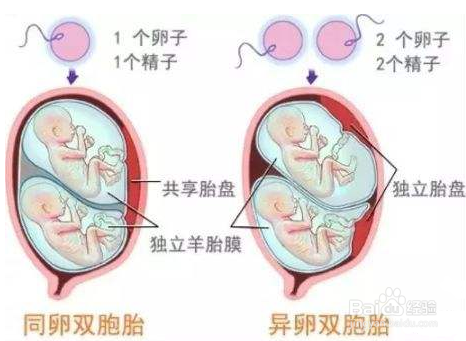 为什么现在双胞胎越来越多?