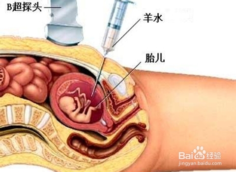 孕妇产前检查分次方案：[2]孕14-19周注意什么