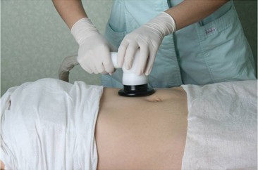 妊娠纹产生后如何淡化