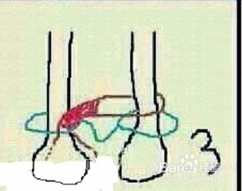 小昭怎么换裤子