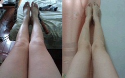 瘦腿最快最有效的秘诀