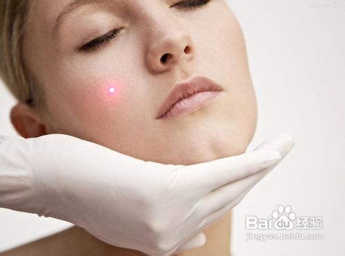 怎么收缩毛孔最快