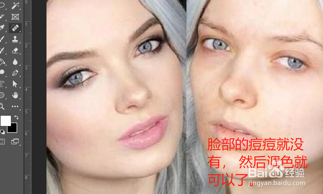 ps如何用污点修复画笔祛痘