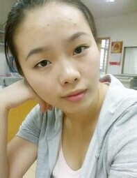 很经常长痘痘怎么办