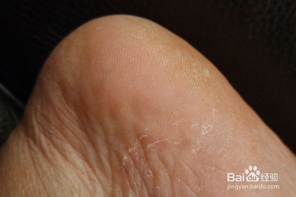 敷完面膜后的面膜纸有哪些妙用？