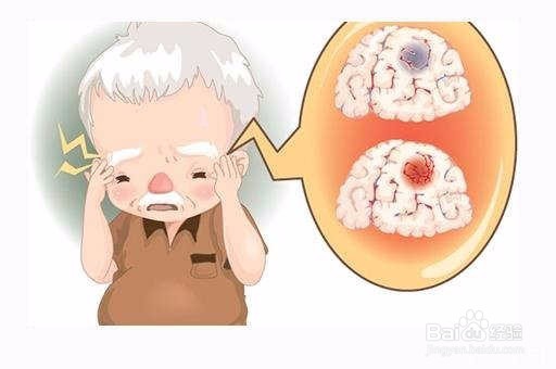 脑梗塞的患者应该注意什么？