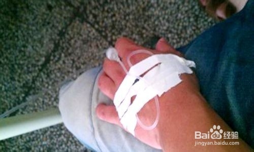 春季怎样防治腮腺炎？