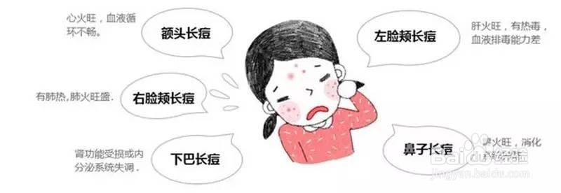 湿气太重怎么办?