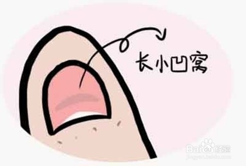 怎么看指甲异常判断宝宝健康状况，以及解决办法