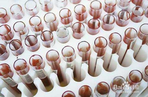 高血压患者哪些项目是必须检查