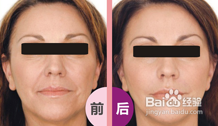 活细胞注射有危害吗？