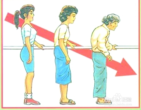 骨质疏松要怎么办