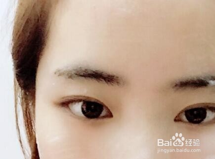 祛痘印最好的方法