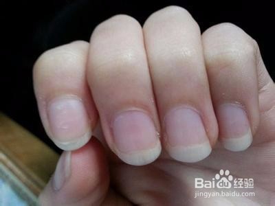 手指甲有点泛白是什么原因