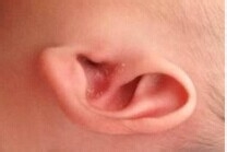 保护孩子听力要注意几点