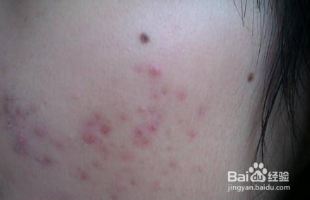 怎么才能有效预防皱纹