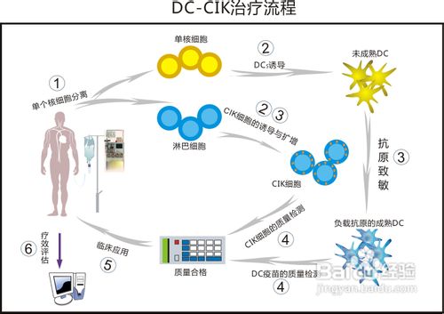 生物免疫治疗喉癌过程。