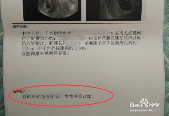 如何计算宝宝预产期?